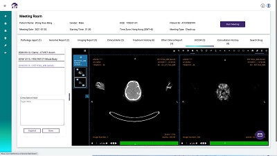覓光遠程醫療研發腫瘤科專科的遠程醫療平台，有系統地整合病人病歷。